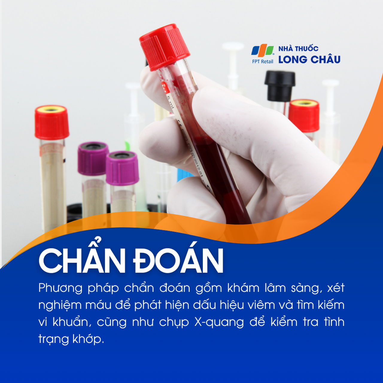 Viêm khớp phản ứng 5
