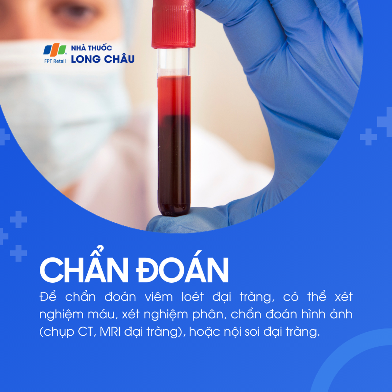 Viêm loét đại tràng 5