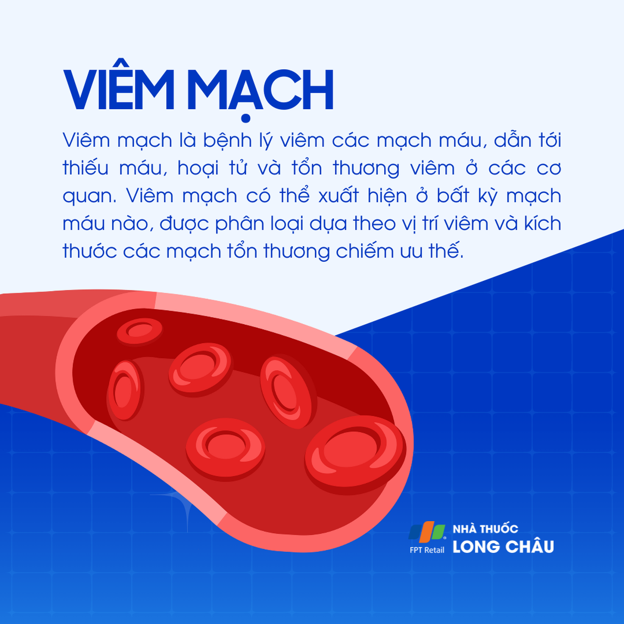 Viêm mạch 1