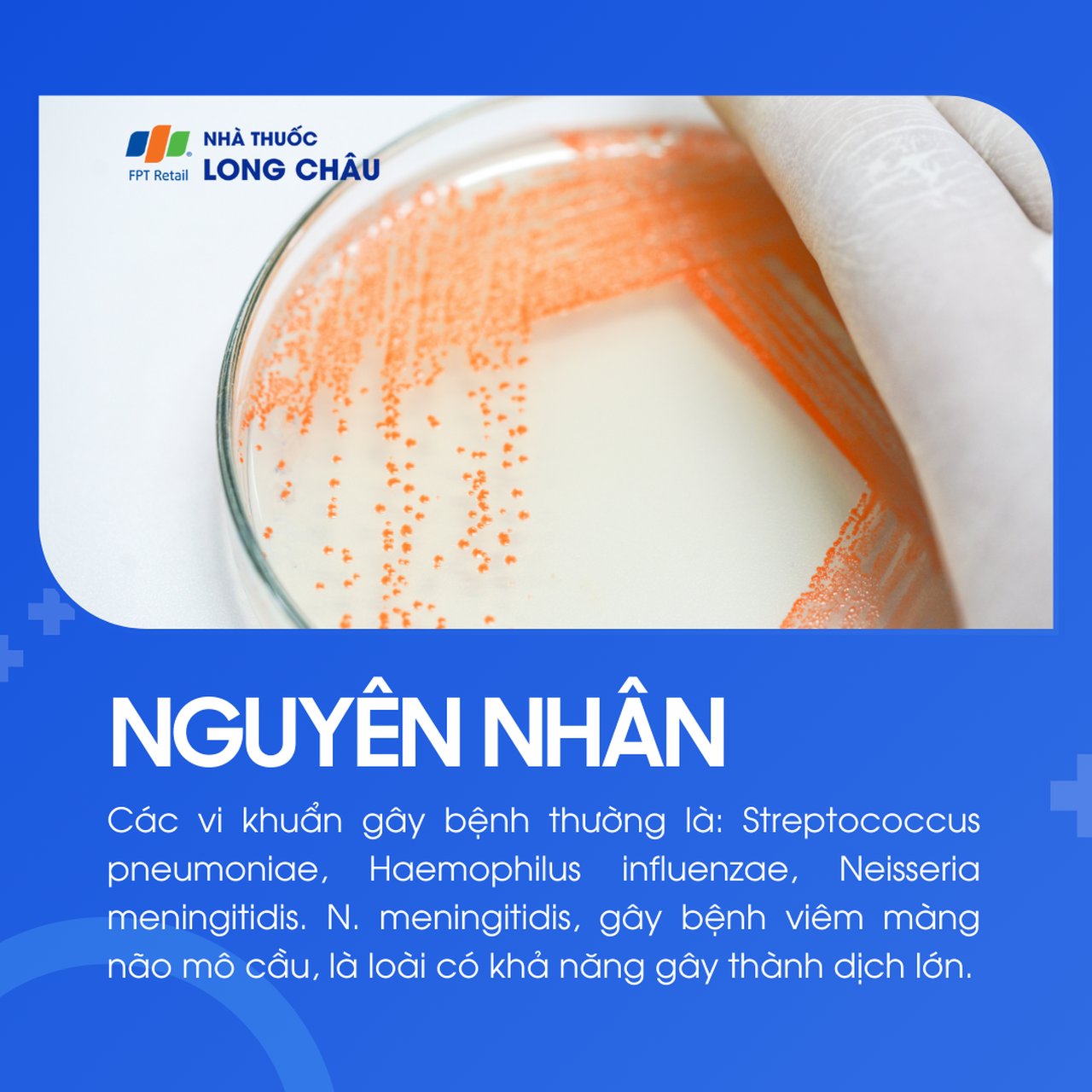 Viêm màng não do phế cầu 3