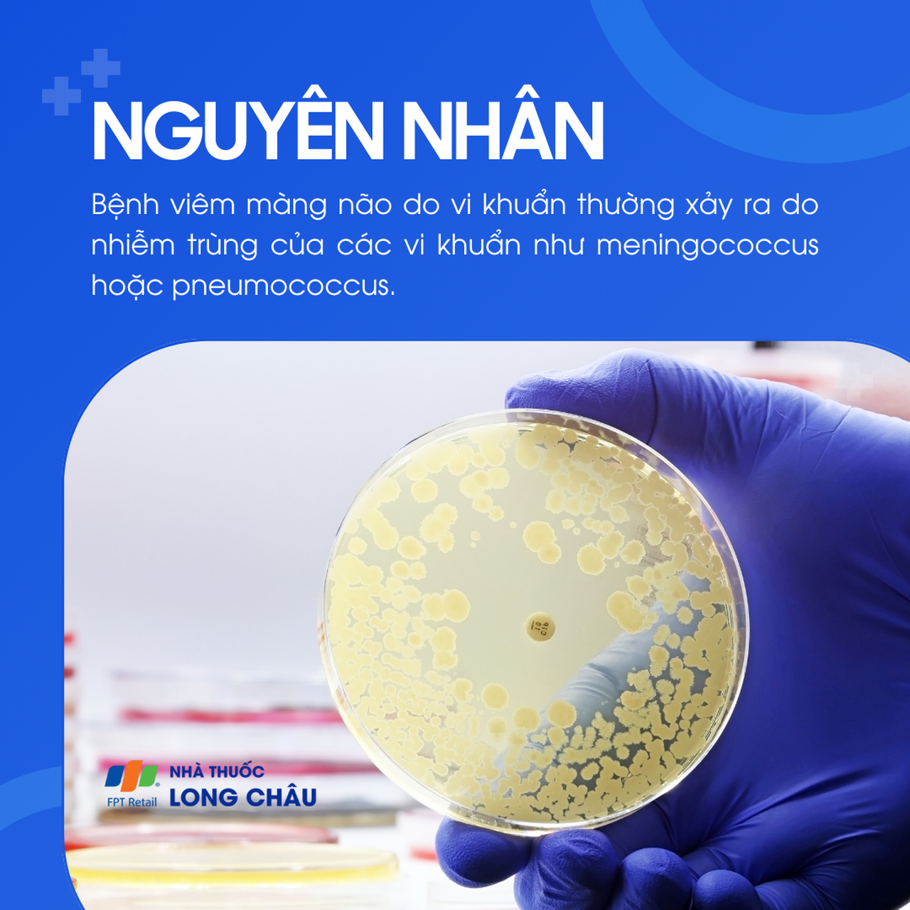 Viêm màng não do vi khuẩn 3