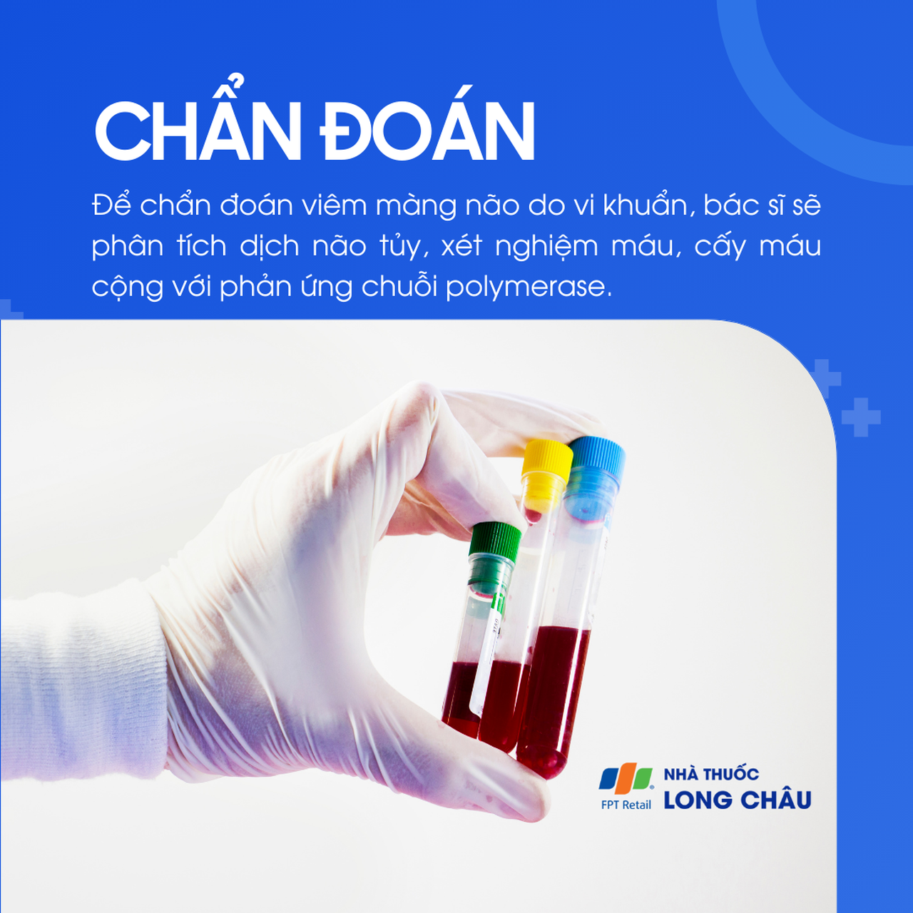 Viêm màng não do vi khuẩn 5