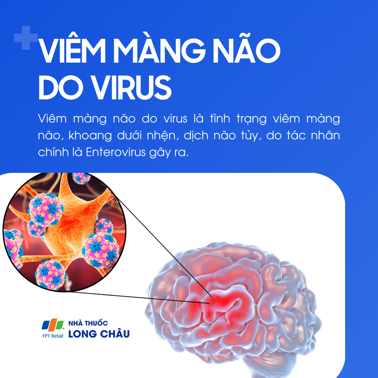 Viêm màng não do virus 1