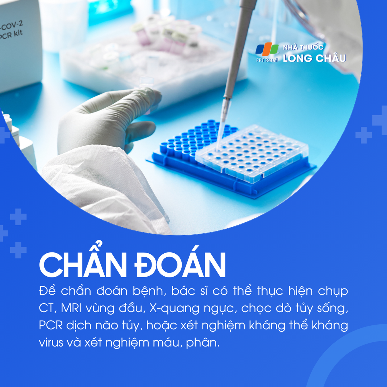 Viêm màng não do virus 5