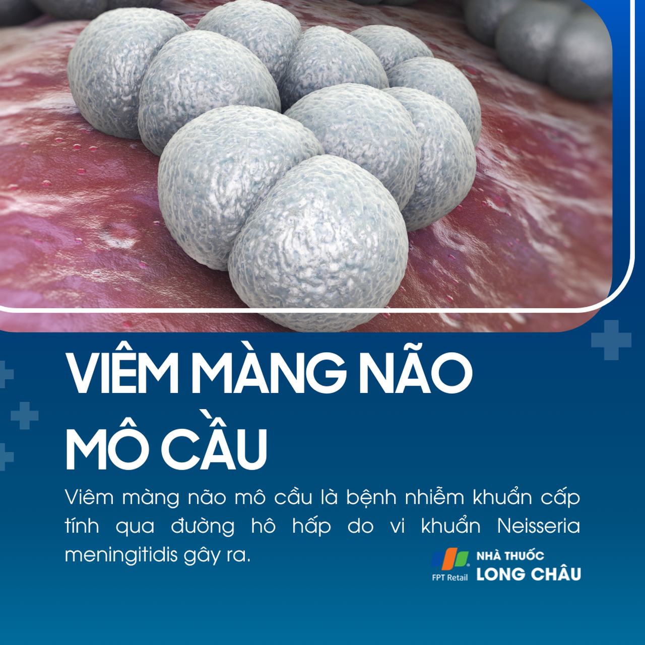 Viêm màng não mô cầu 1