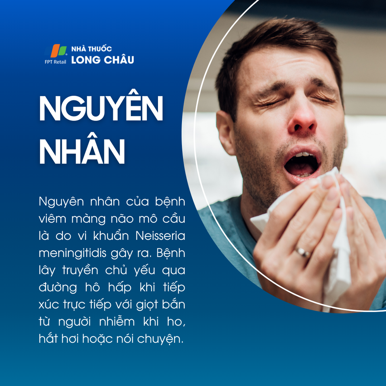 Viêm màng não mô cầu 3