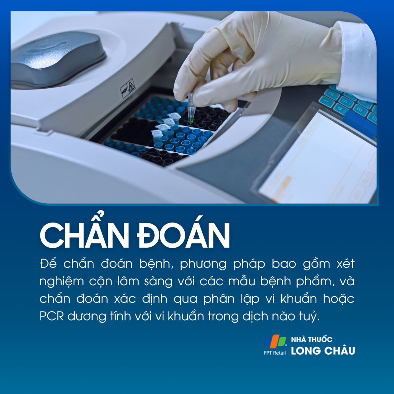 Viêm màng não mô cầu 5