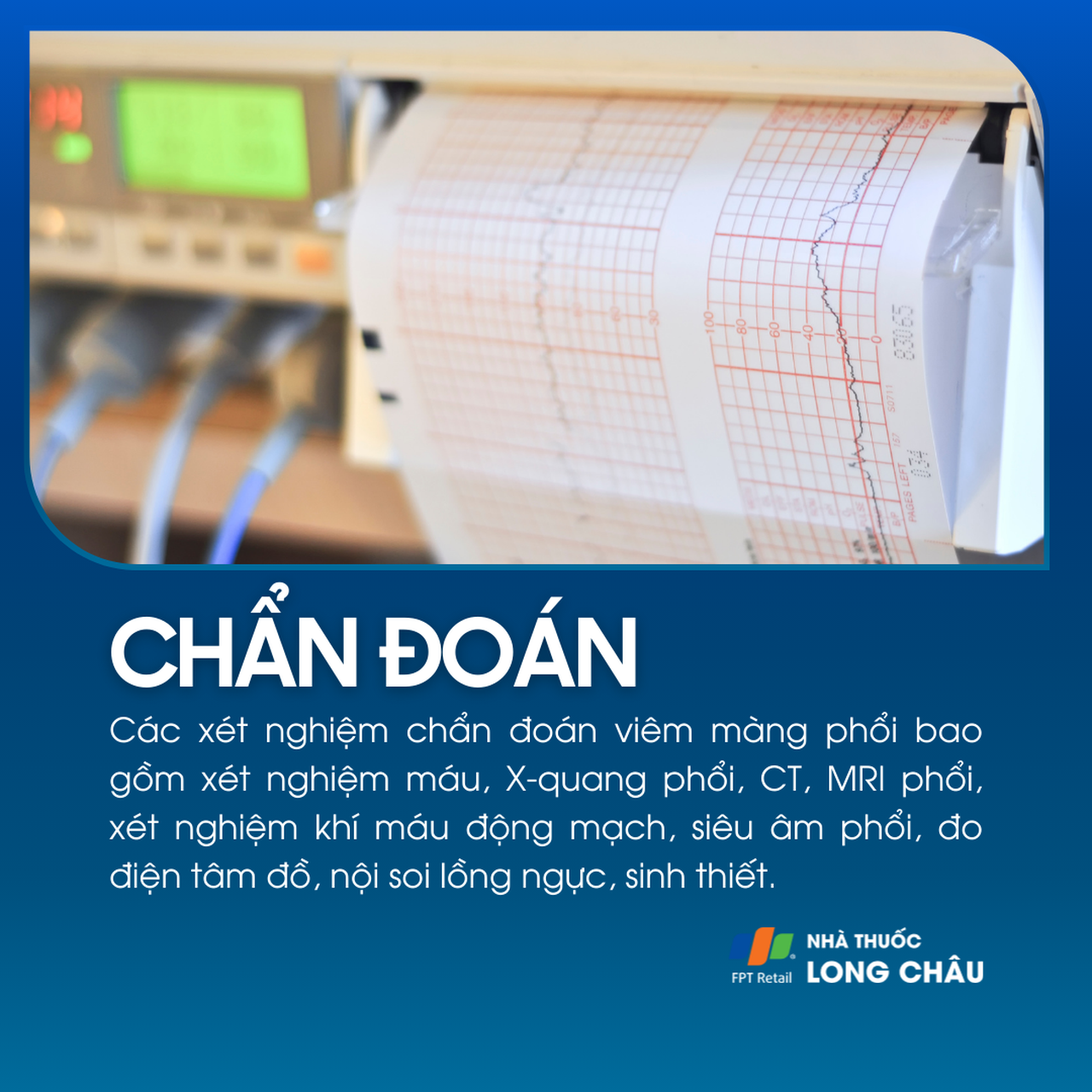 Viêm màng phổi 5
