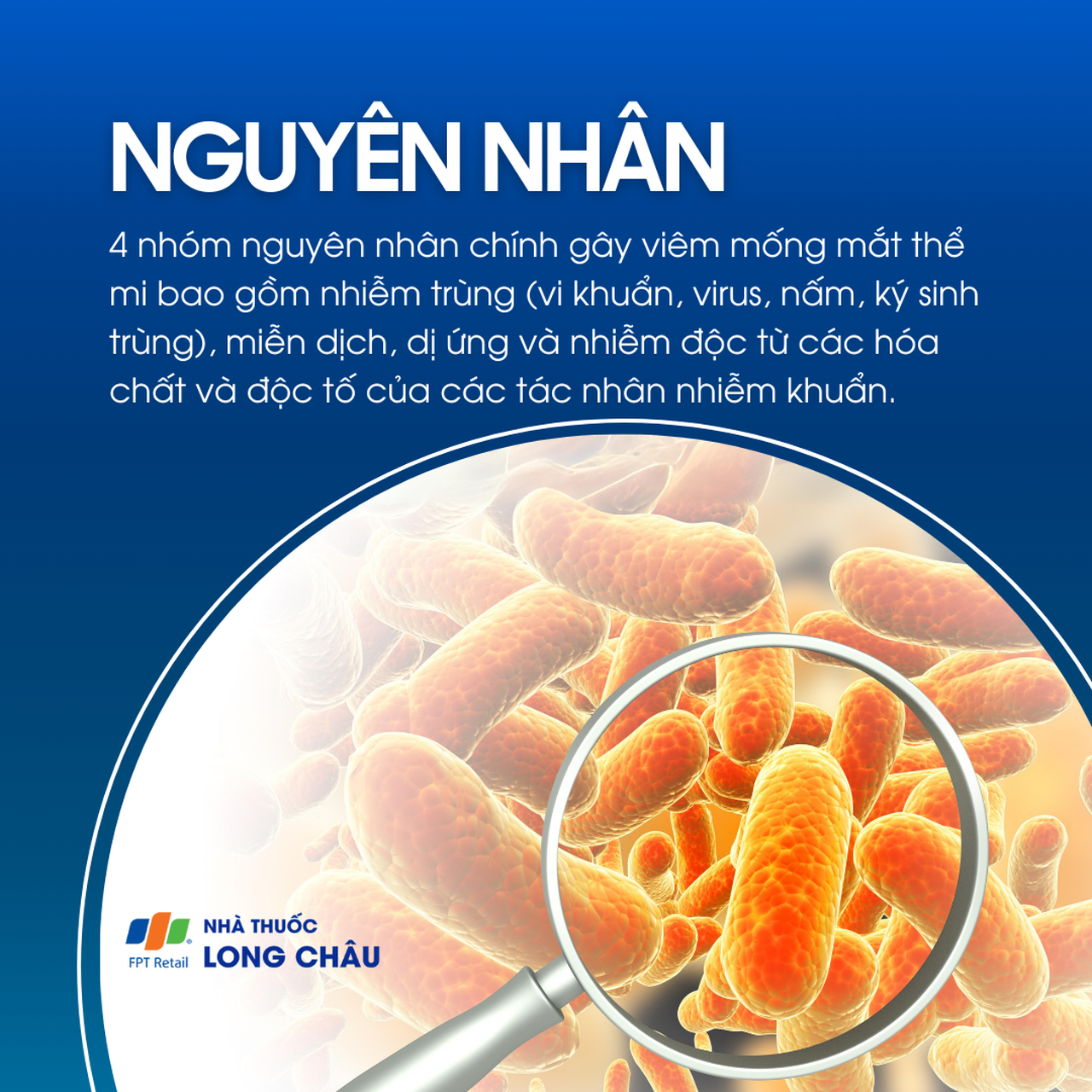 Viêm mống mắt thể mi 3