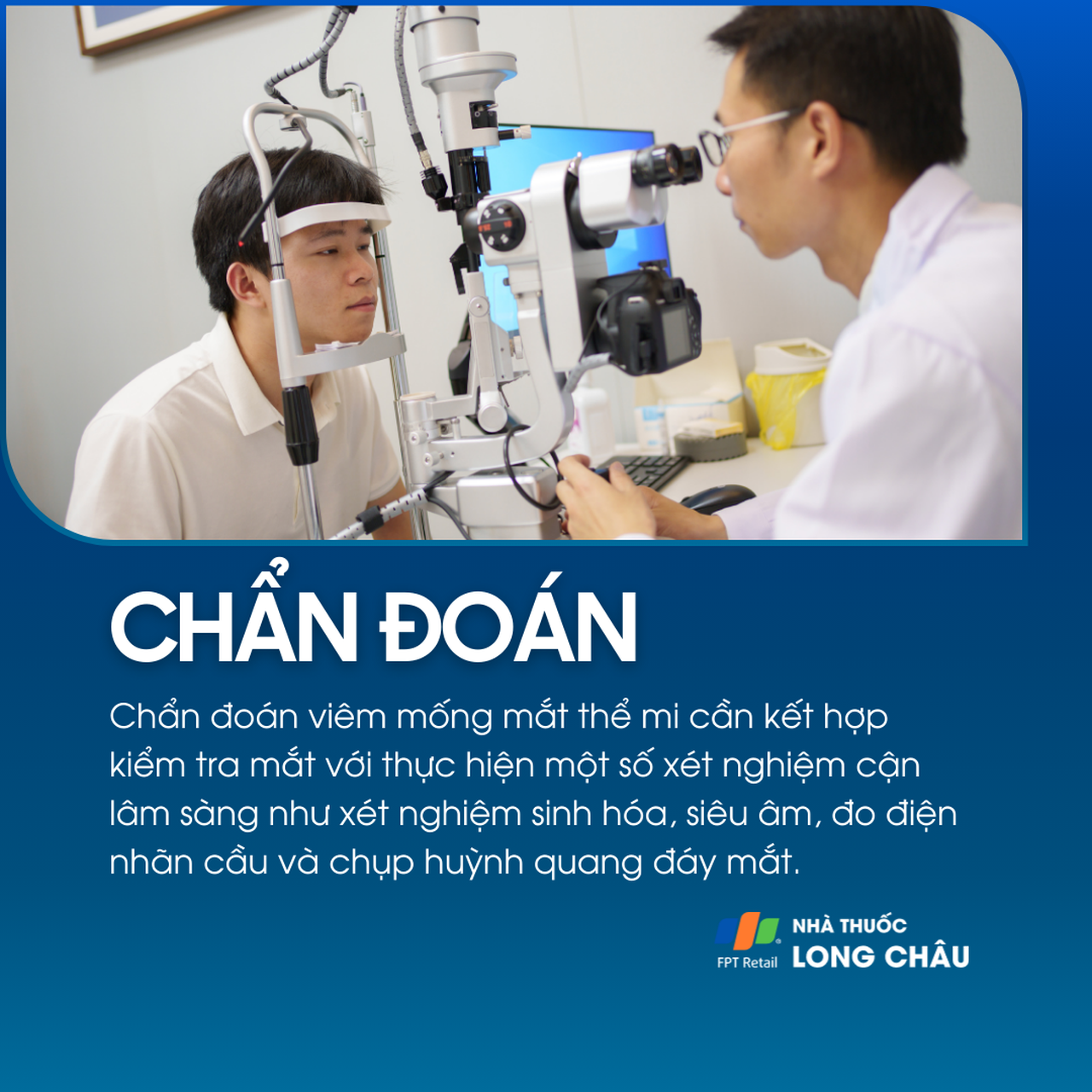 Viêm mống mắt thể mi 5