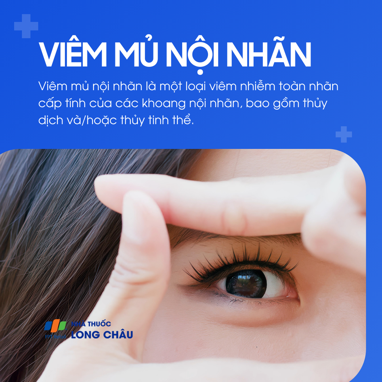 Viêm mủ nội nhãn 1