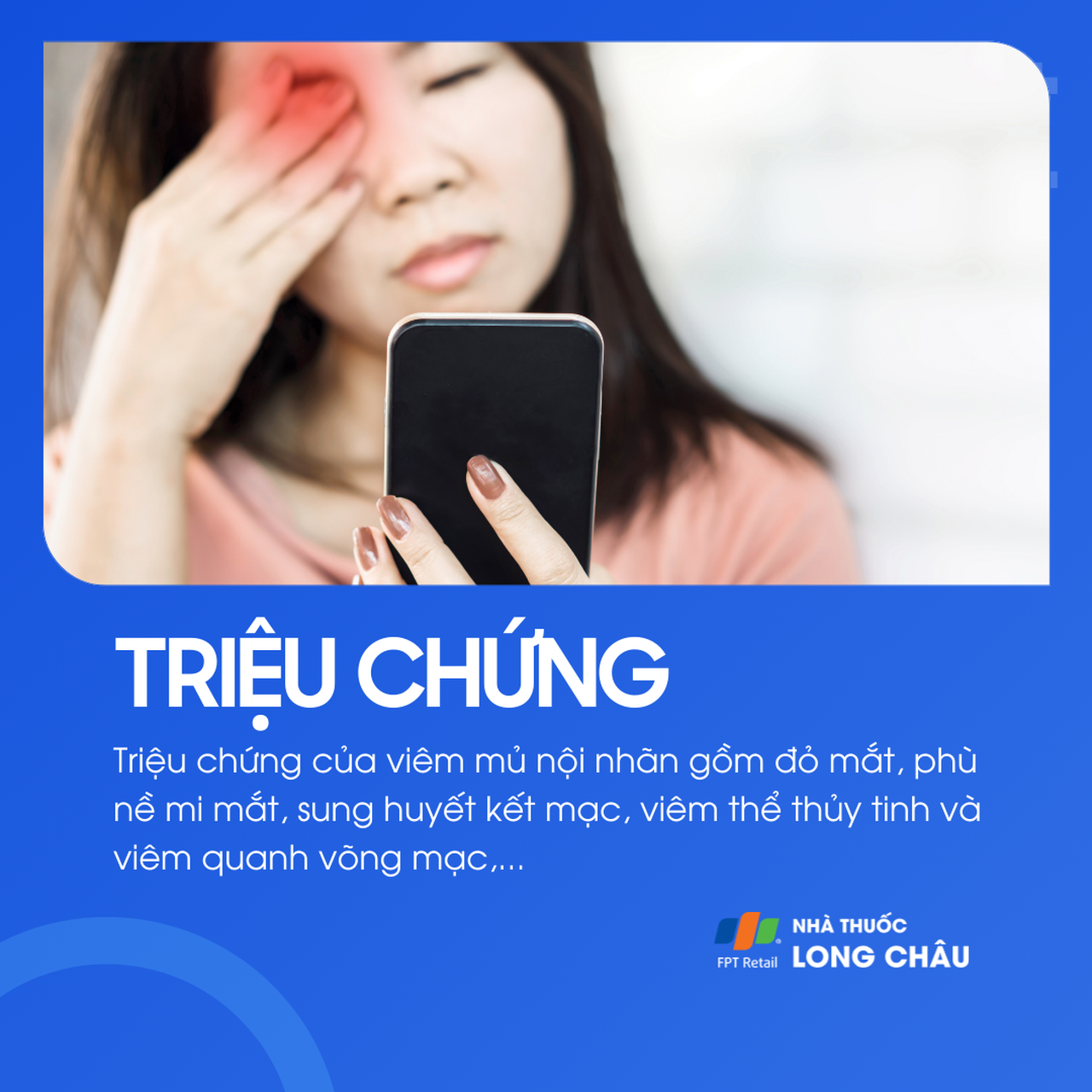 Viêm mủ nội nhãn 2