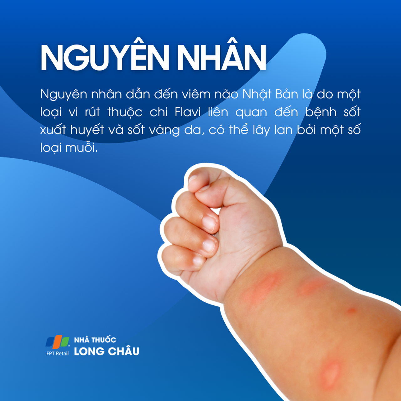 Vi rút viêm não Nhật Bản là một loại vi rút flavivirus liên quan đến bệnh sốt xuất huyết