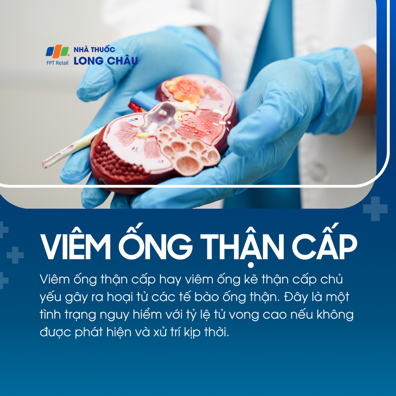 Viêm ống thận cấp 1
