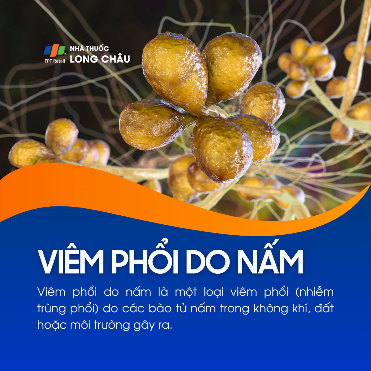 Viêm phổi do nấm 1