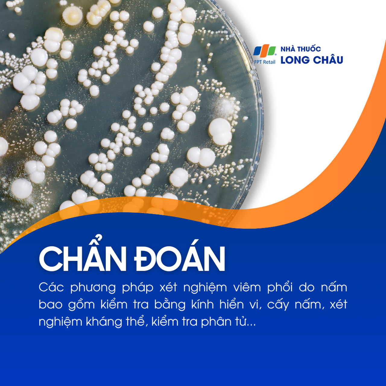 Viêm phổi do nấm 5