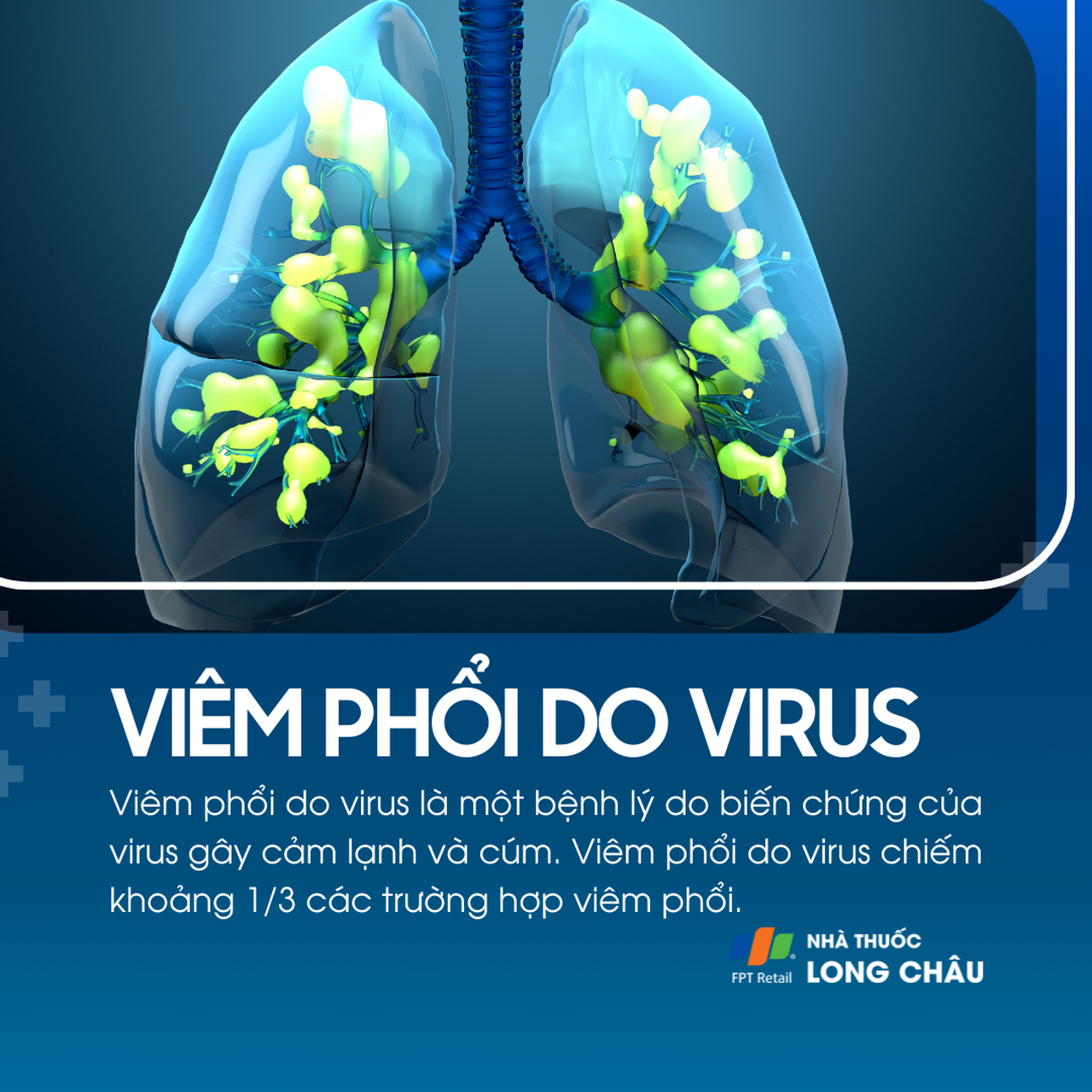 Viêm phổi do virus 1