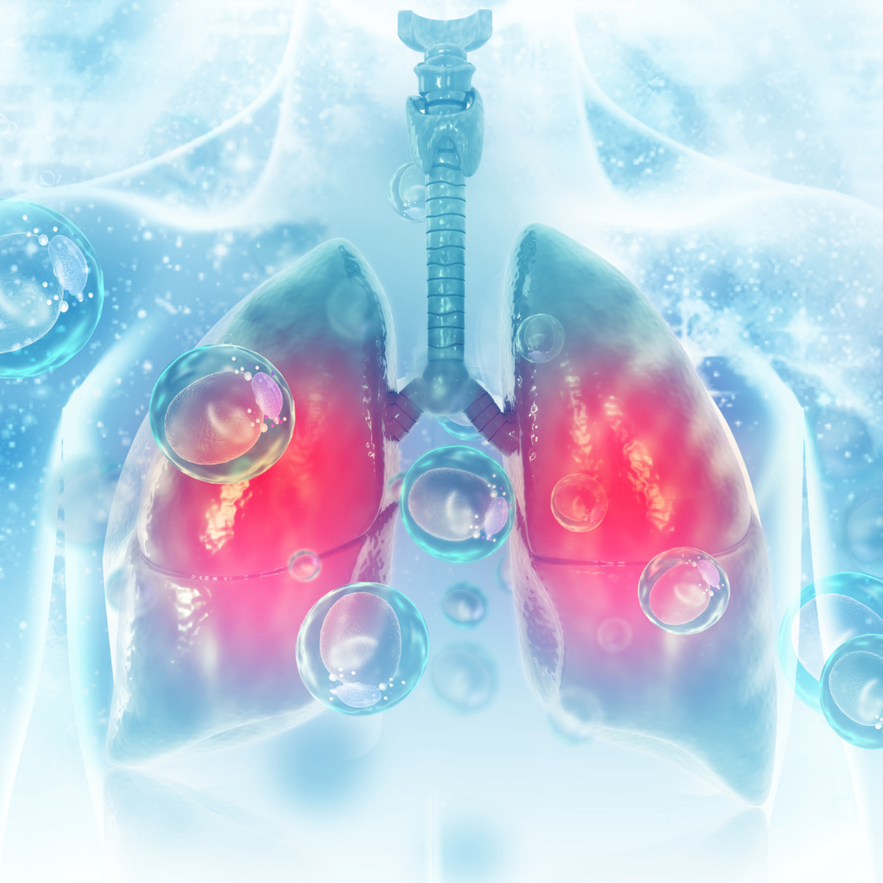  Viêm phổi kẽ là gì? Nguyên nhân, triệu chứng và cách điều trị 1