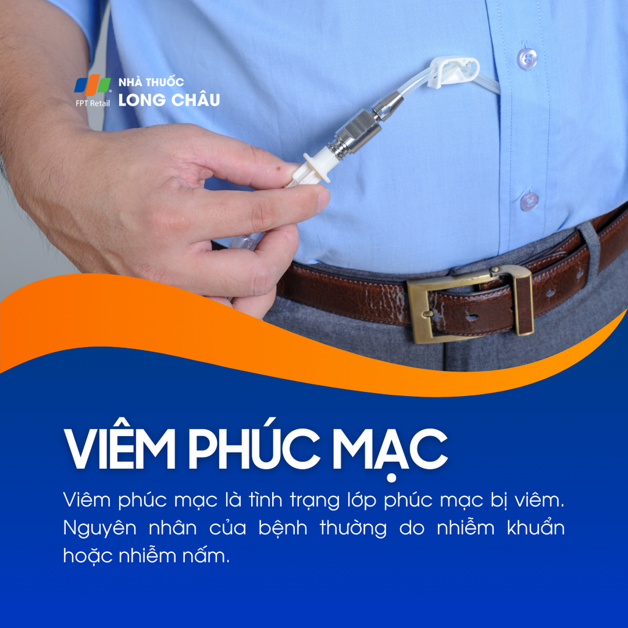 Viêm phúc mạc 1
