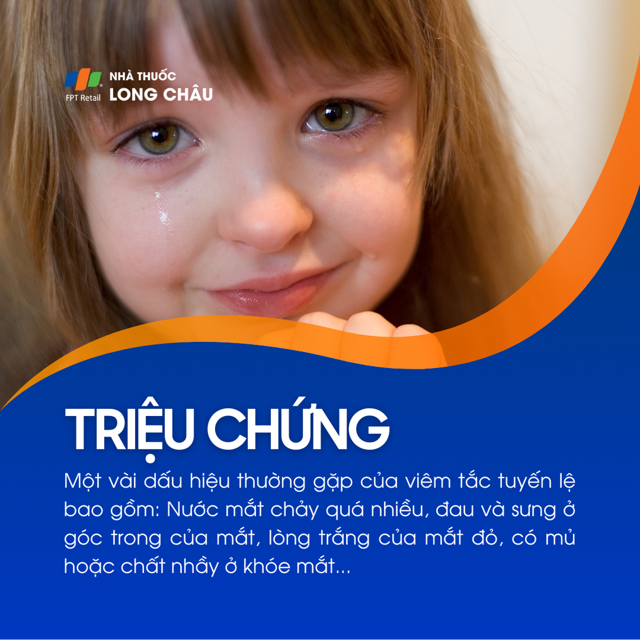 Viêm tắc tuyến lệ 2