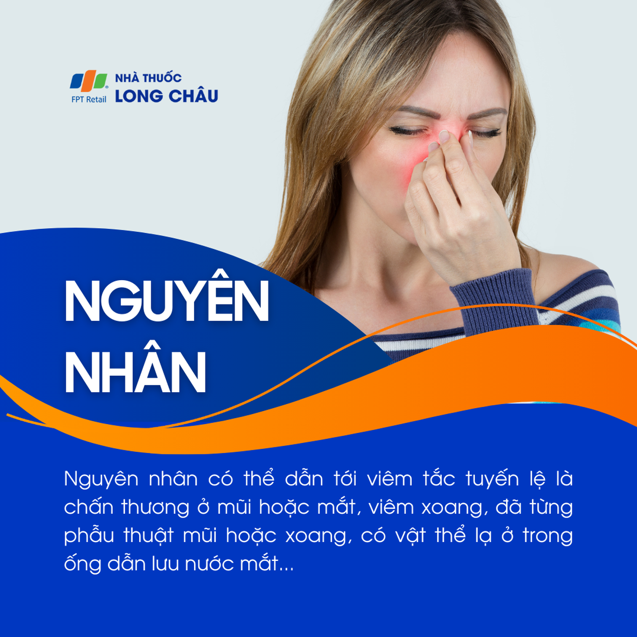 Viêm tắc tuyến lệ 3