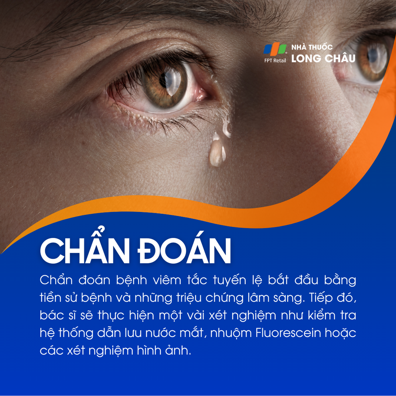 Viêm tắc tuyến lệ 5