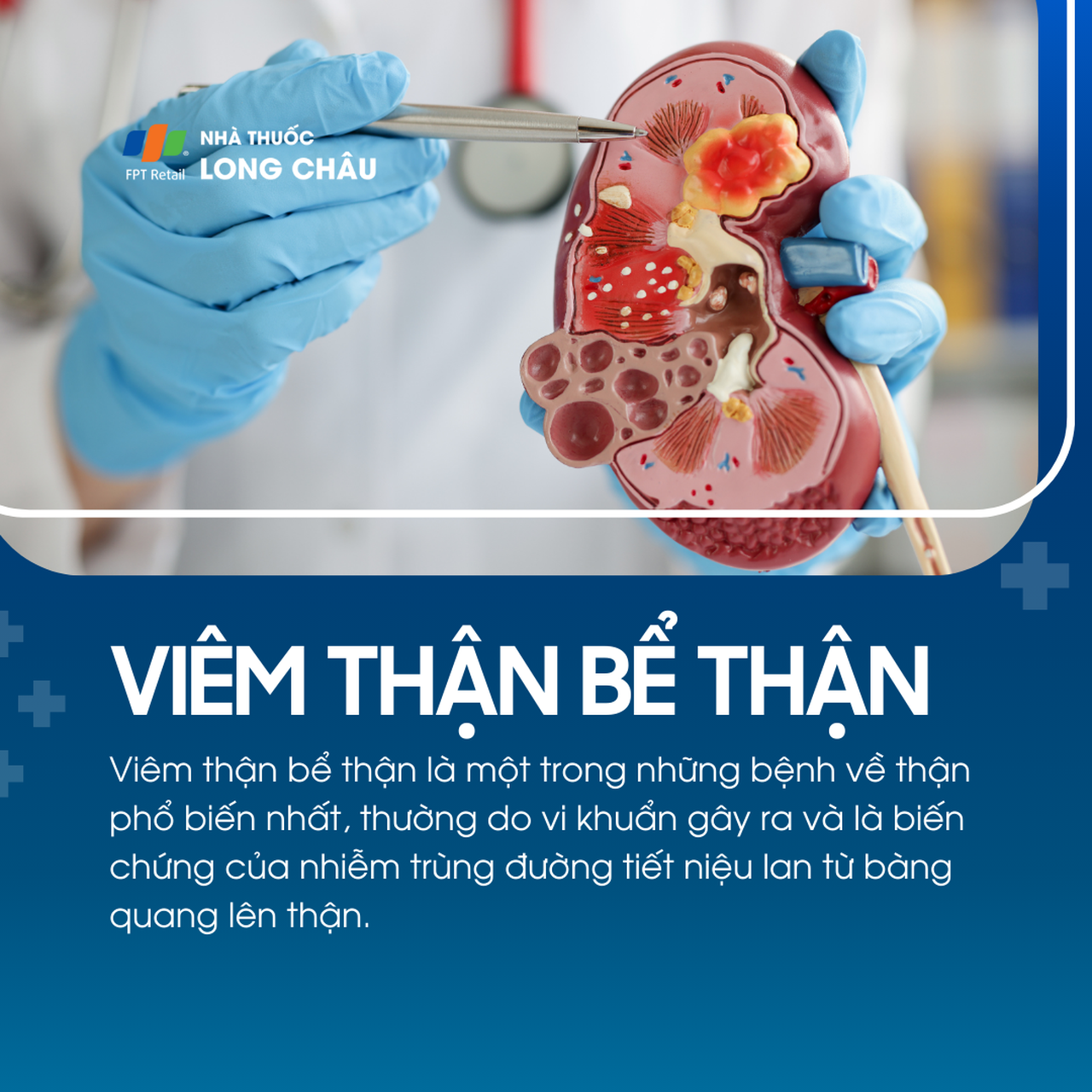 Viêm thận bể thận 1