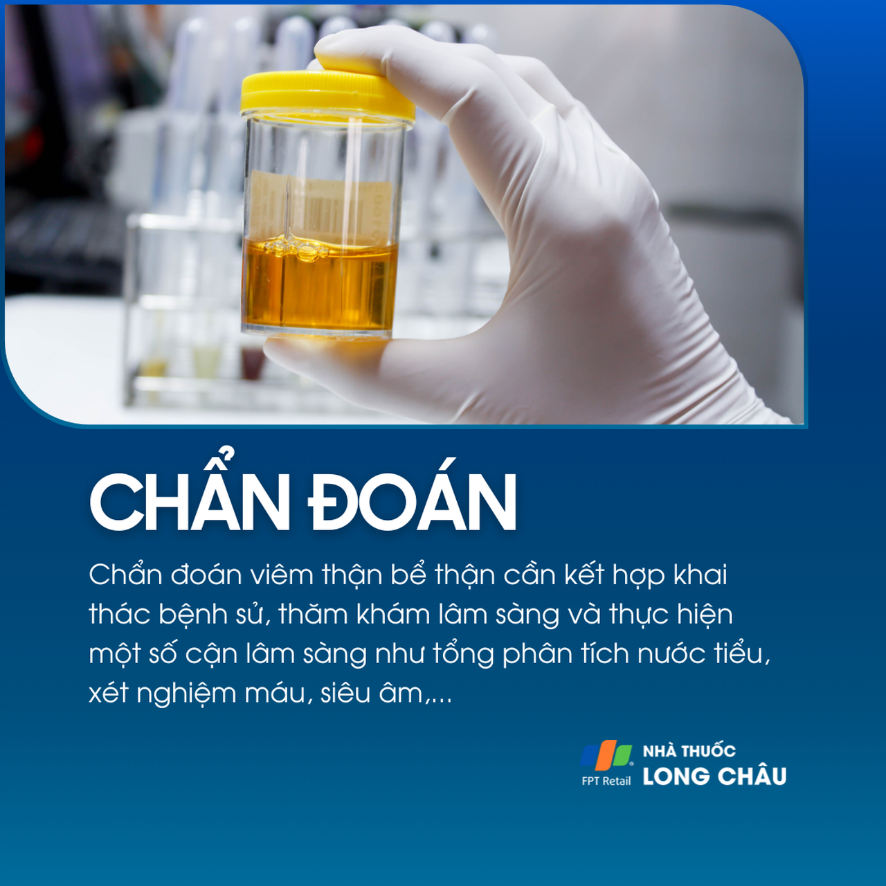 Viêm thận bể thận 5