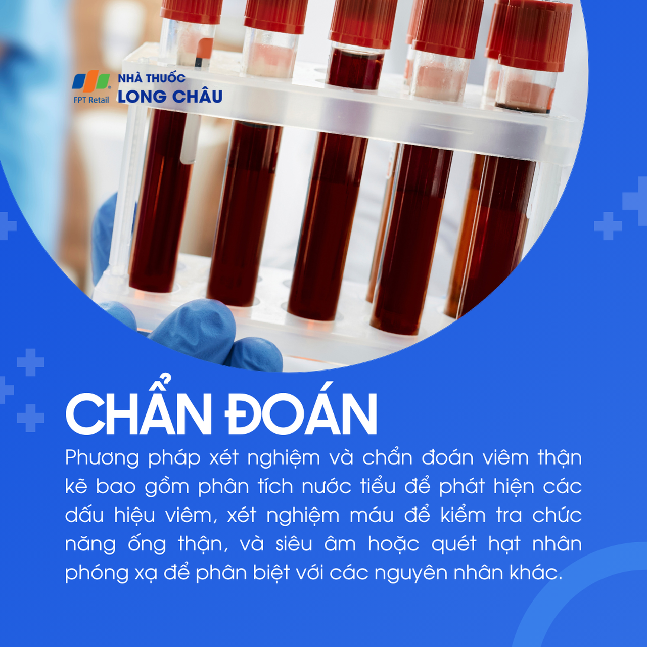 Viêm thận kẽ 7