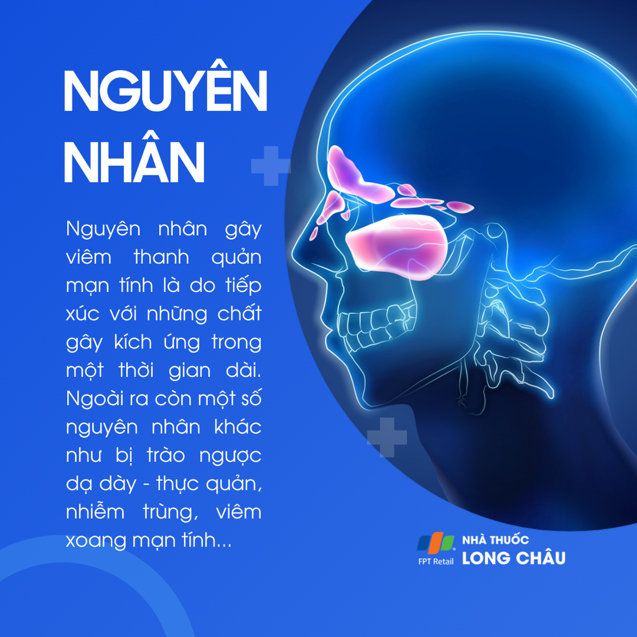 Viêm thanh quản mạn tính 3