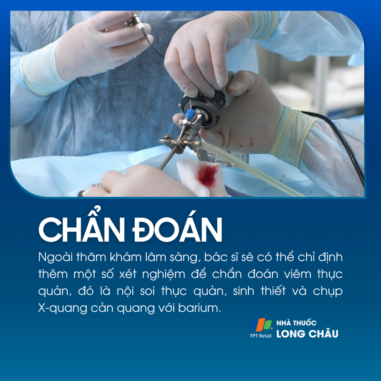 Viêm thực quản 5