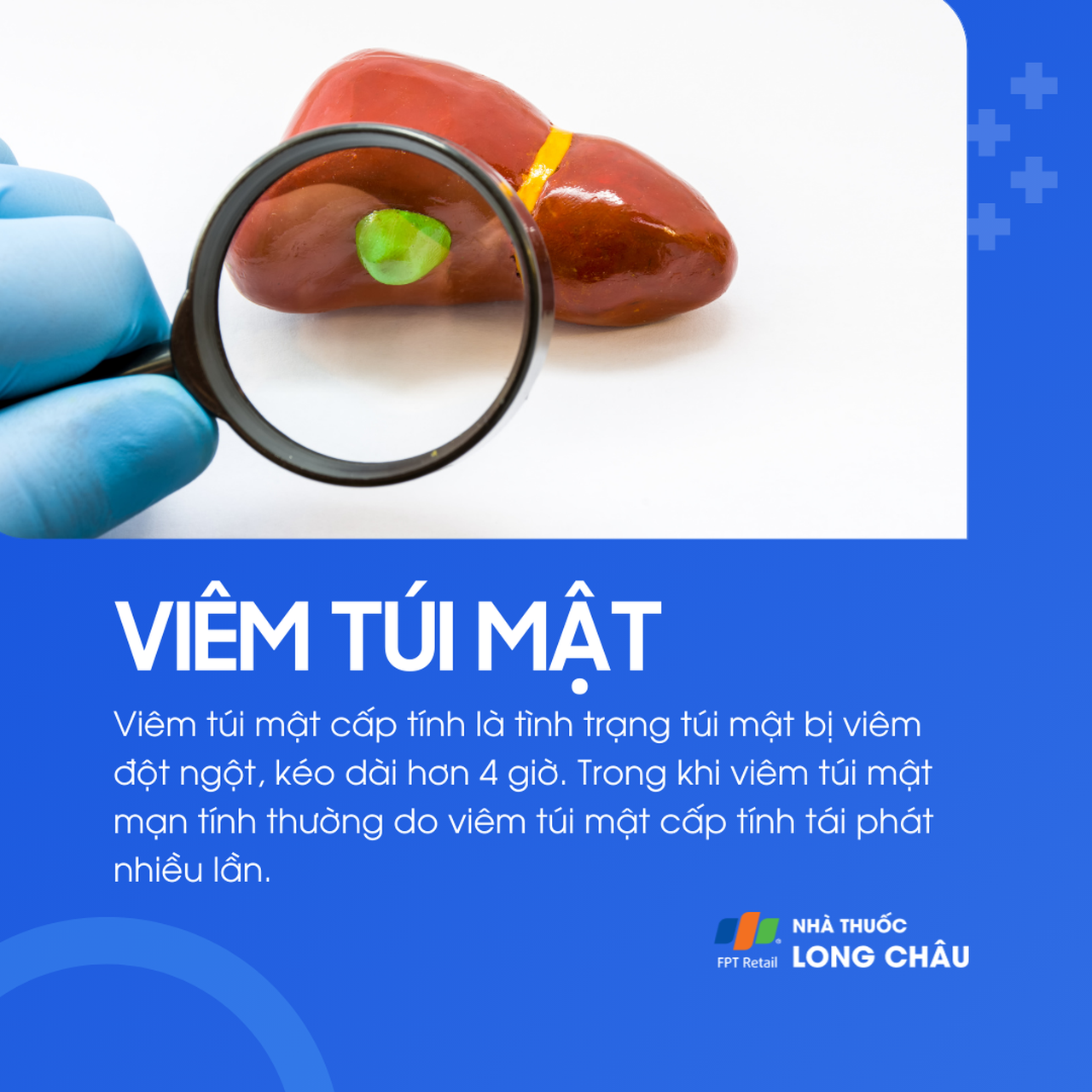 Viêm túi mật 2