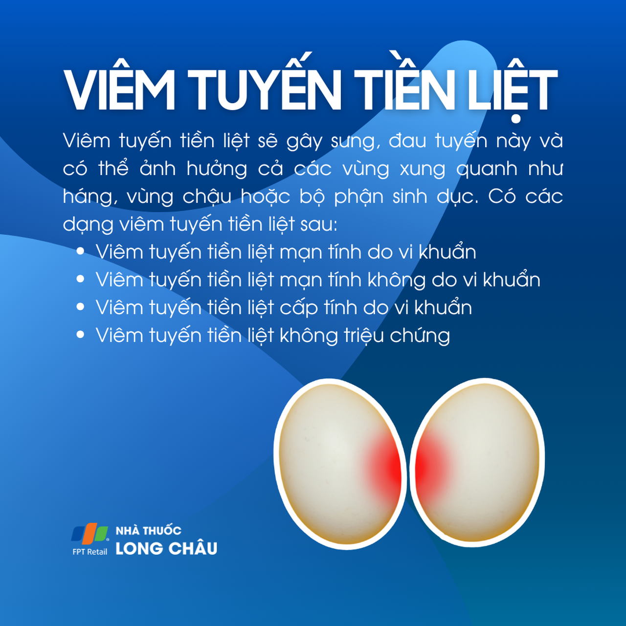 Viêm tuyến tiền liệt 1