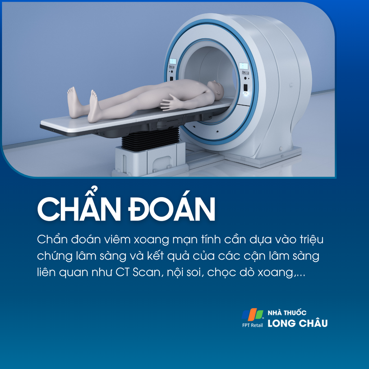 Viêm xoang mạn tính 5