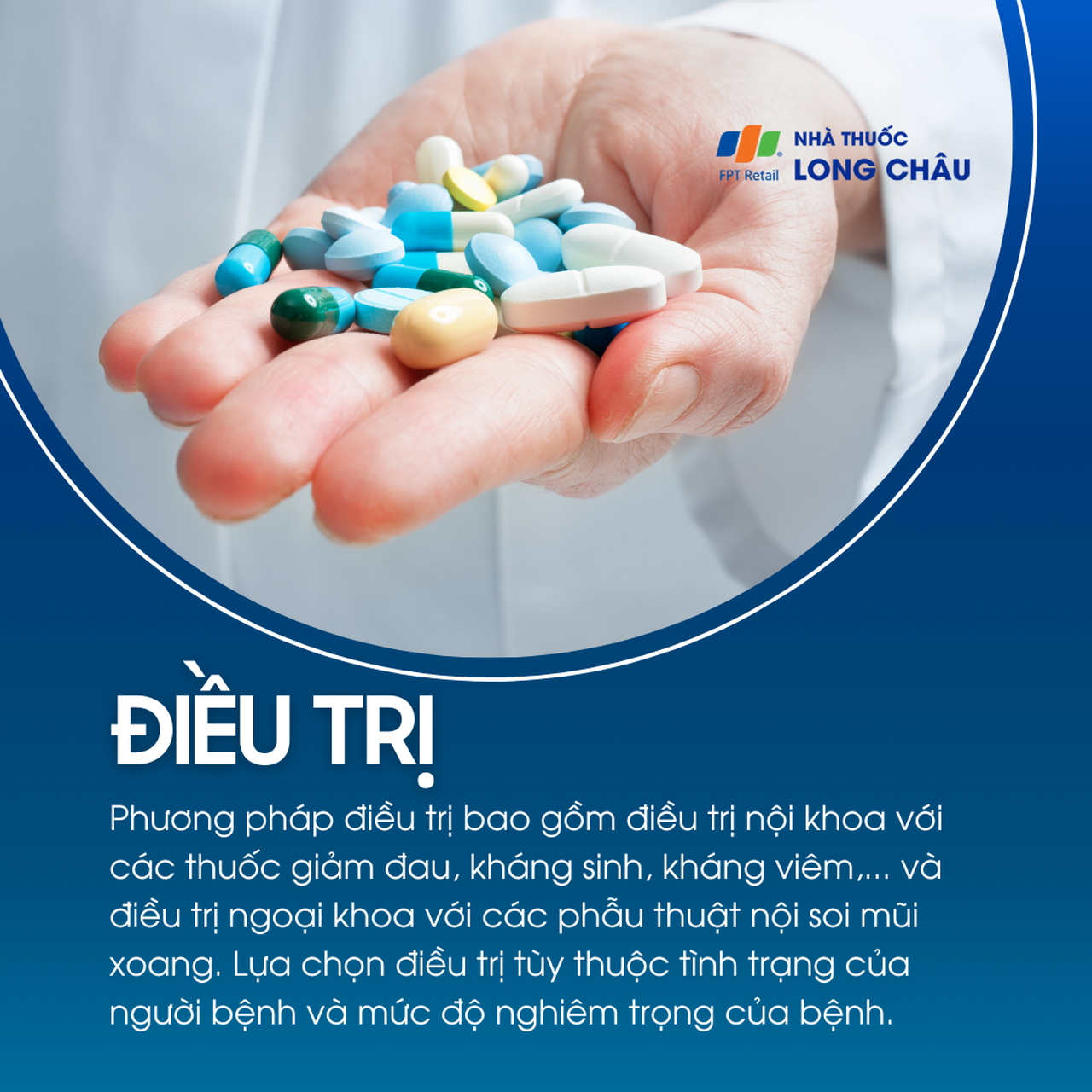 Viêm xoang mạn tính 6