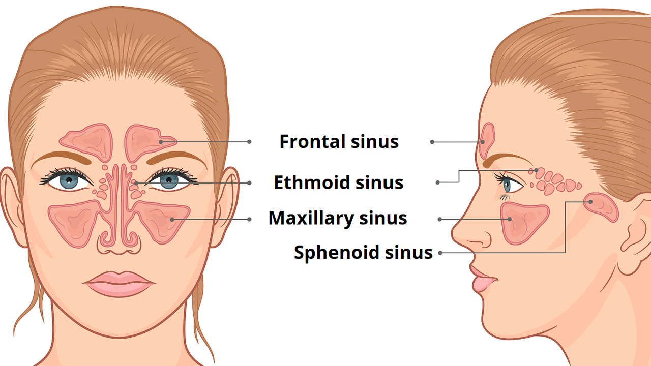 Viêm xoang sàng sau là gì? Những vấn đề cần biết về viêm xoang sàng sau 3