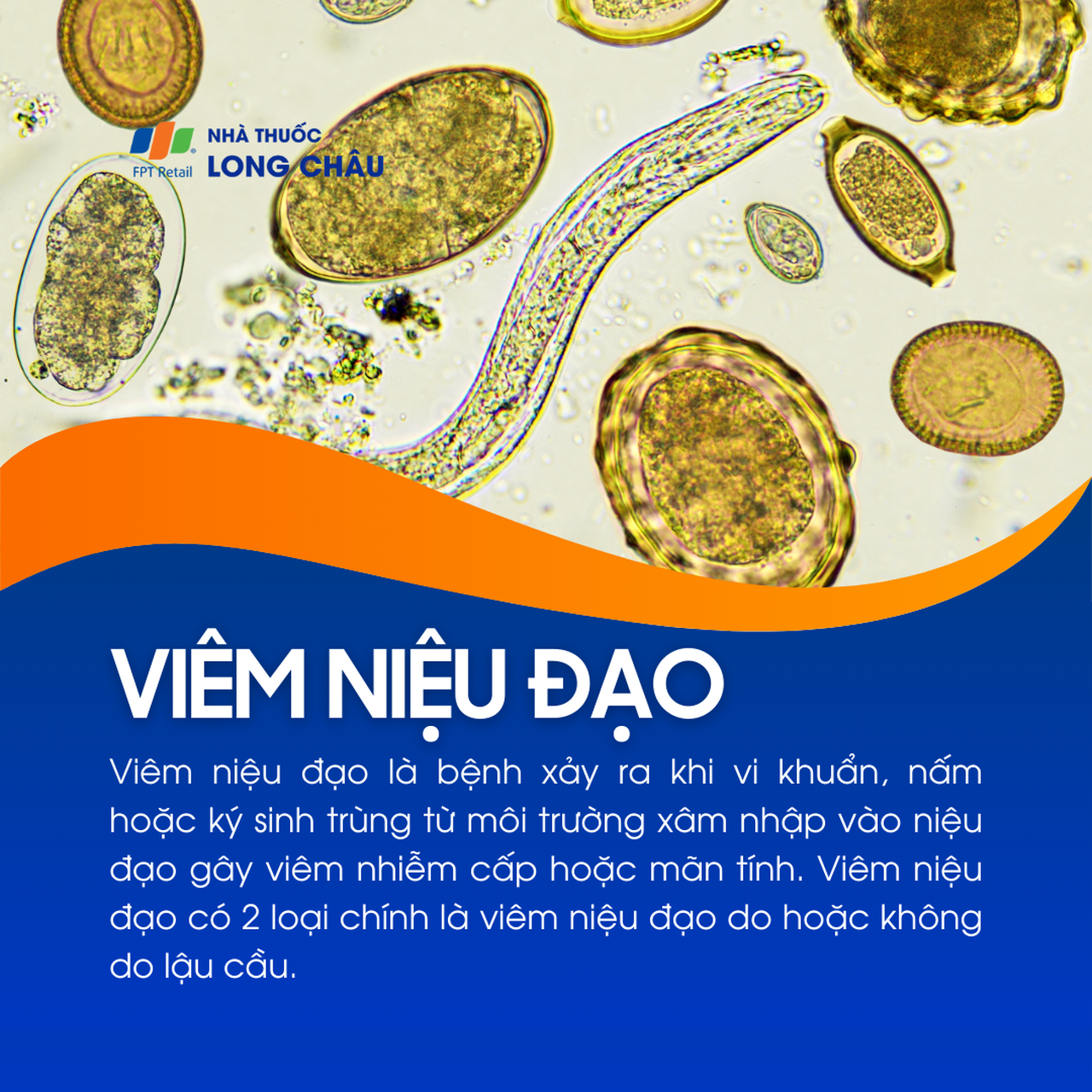 Viêm niệu đạo 1