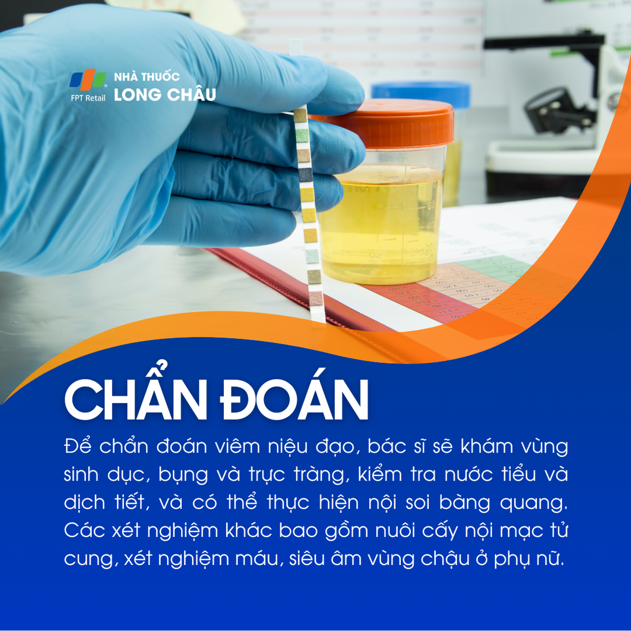 Viêm niệu đạo 5