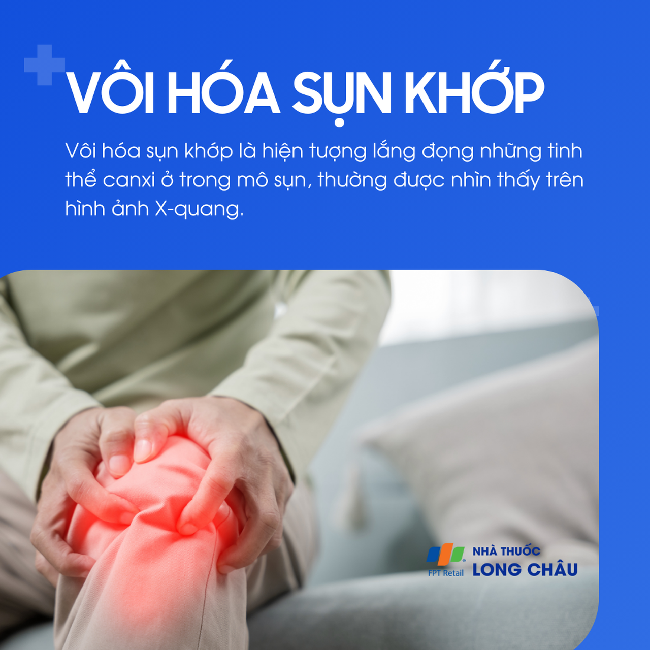 Vôi hóa sụn khớp 1