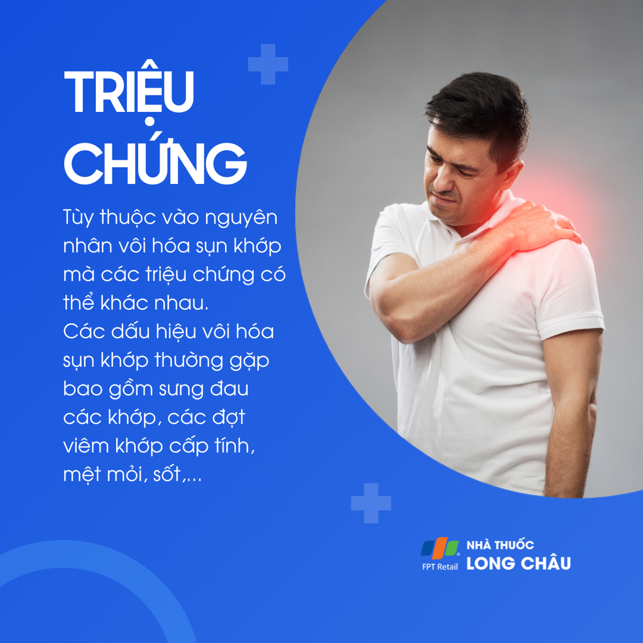 Vôi hóa sụn khớp 2