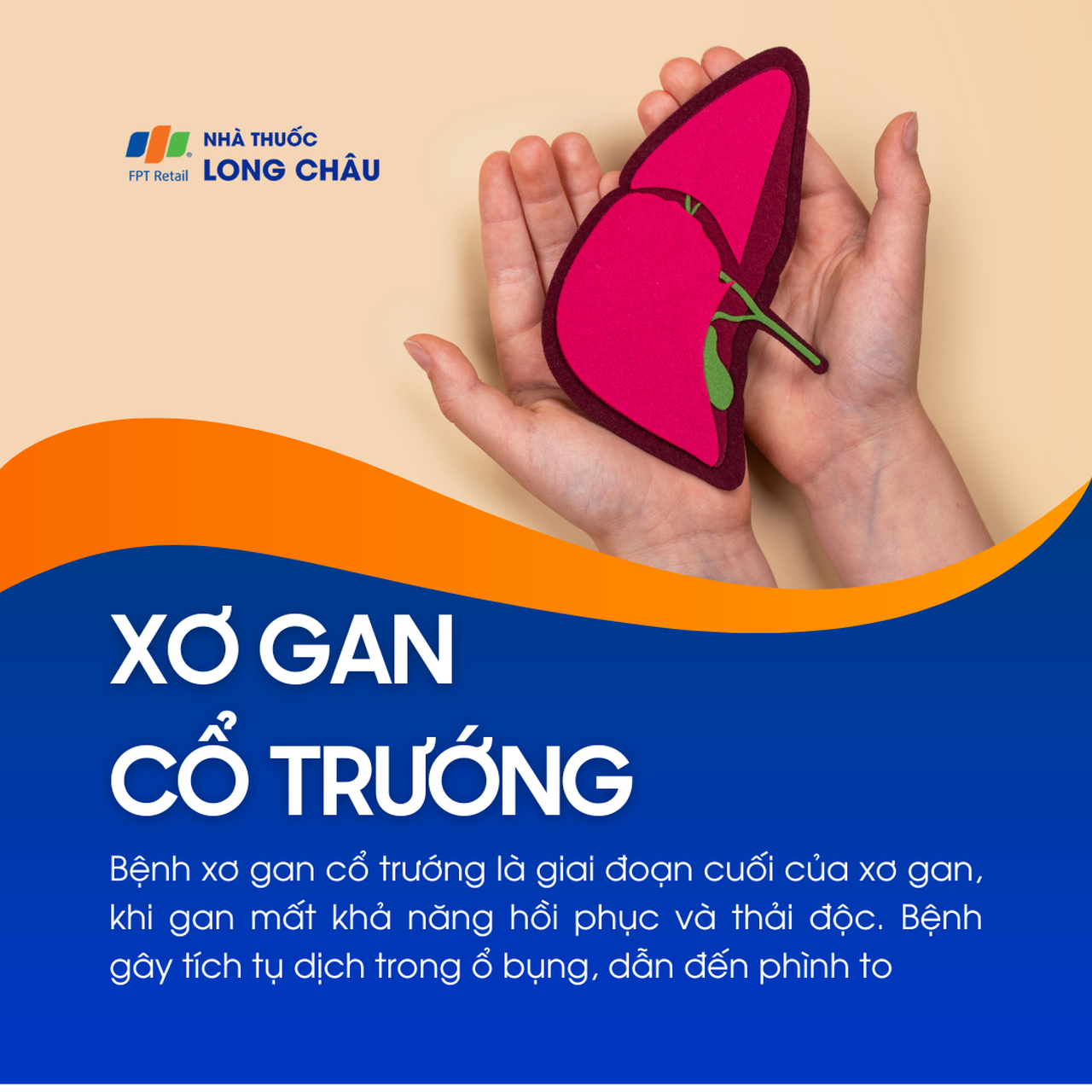 Xơ gan cổ trướng 1