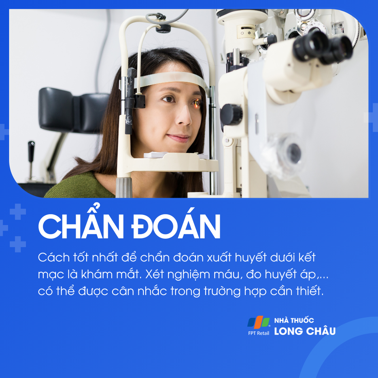 Xuất huyết dưới kết mạc 5