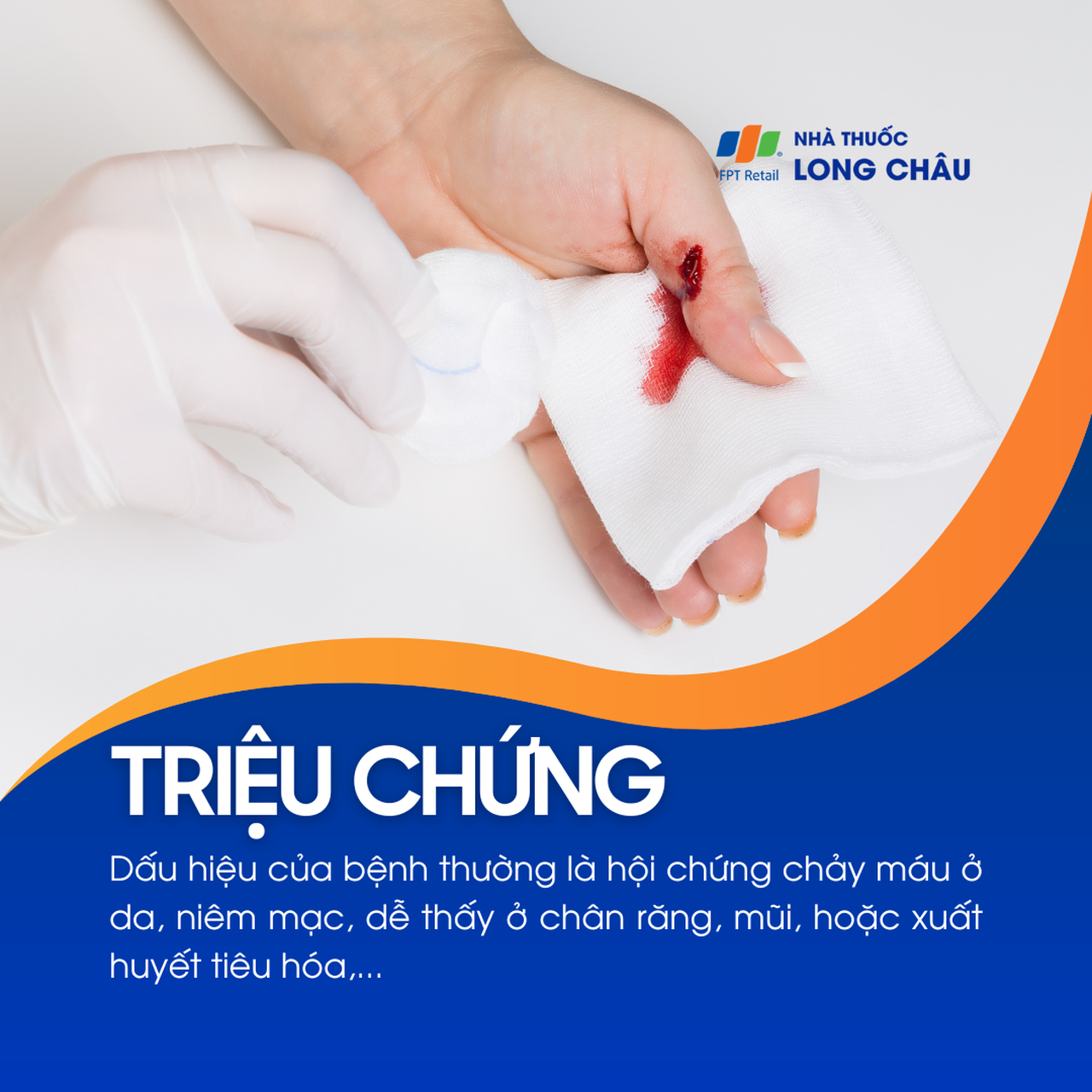 Xuất huyết giảm tiểu cầu 2
