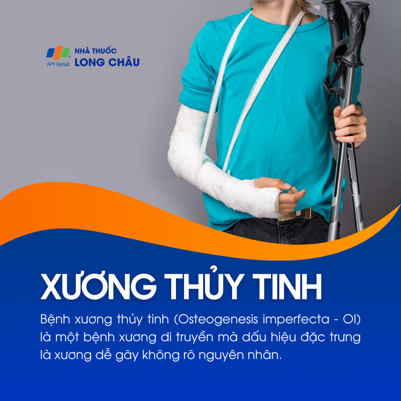 Xương thủy tinh 1