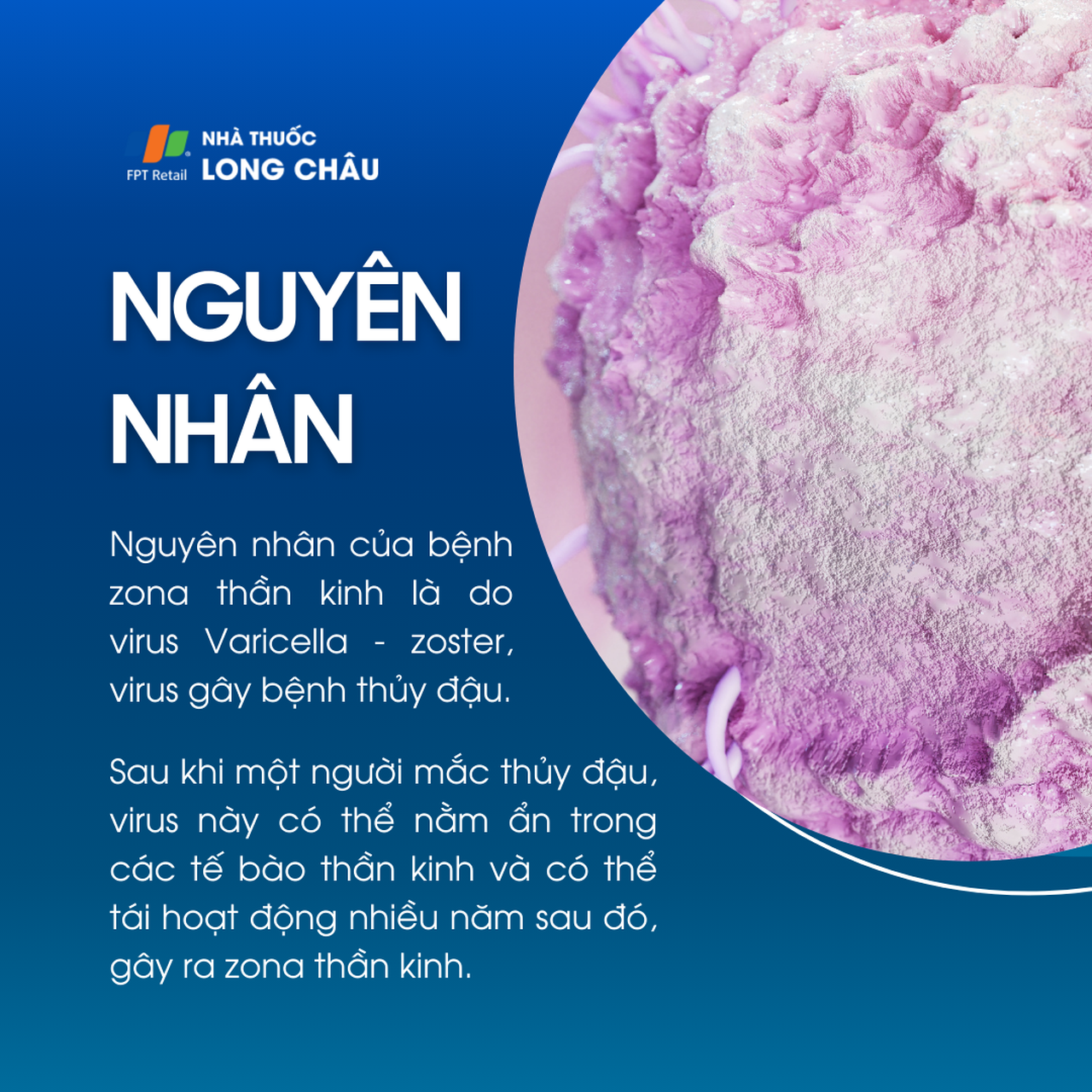 Nguyên nhân bệnh zona thần kinh do virus thủy đậu tái hoạt động