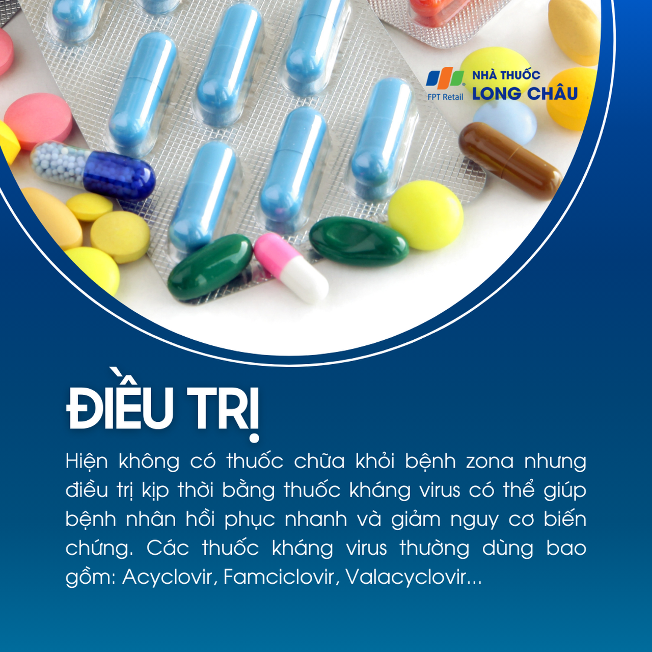 Điều trị bệnh zona thần kinh bằng thuốc kháng virus