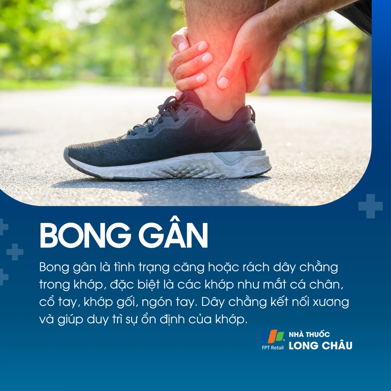 Bong gân là tổn thương dây chằng do kéo căng hoặc rách, thường gặp ở cổ tay, cổ chân, khớp gối, ngón tay