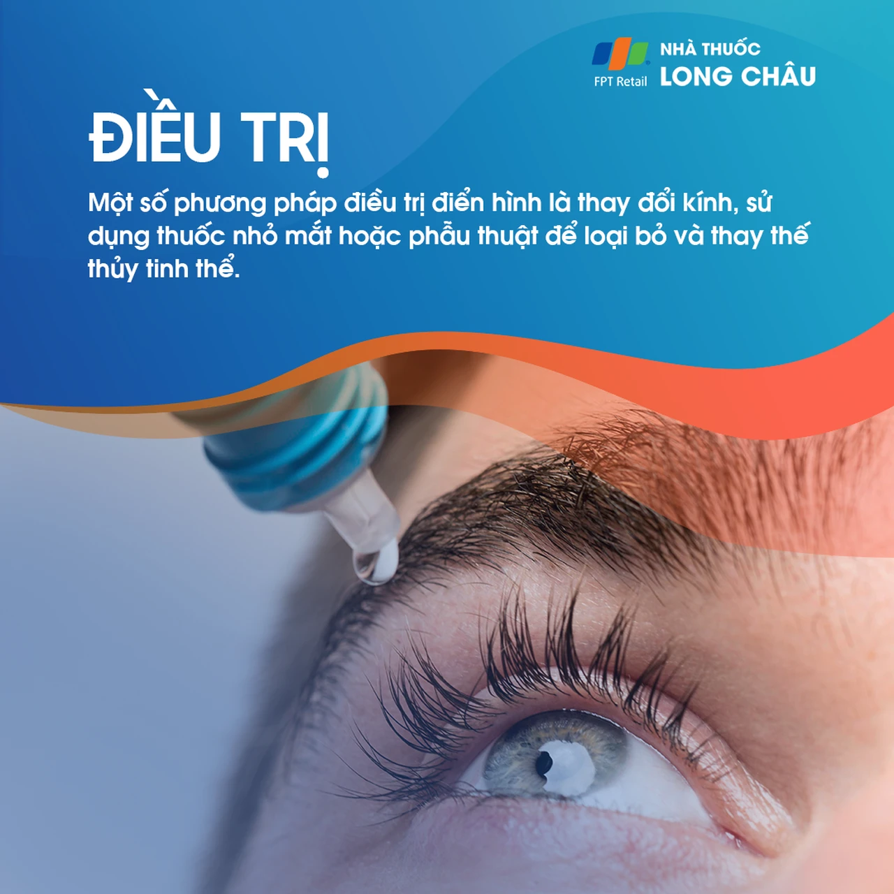 Đục thủy tinh thể 6