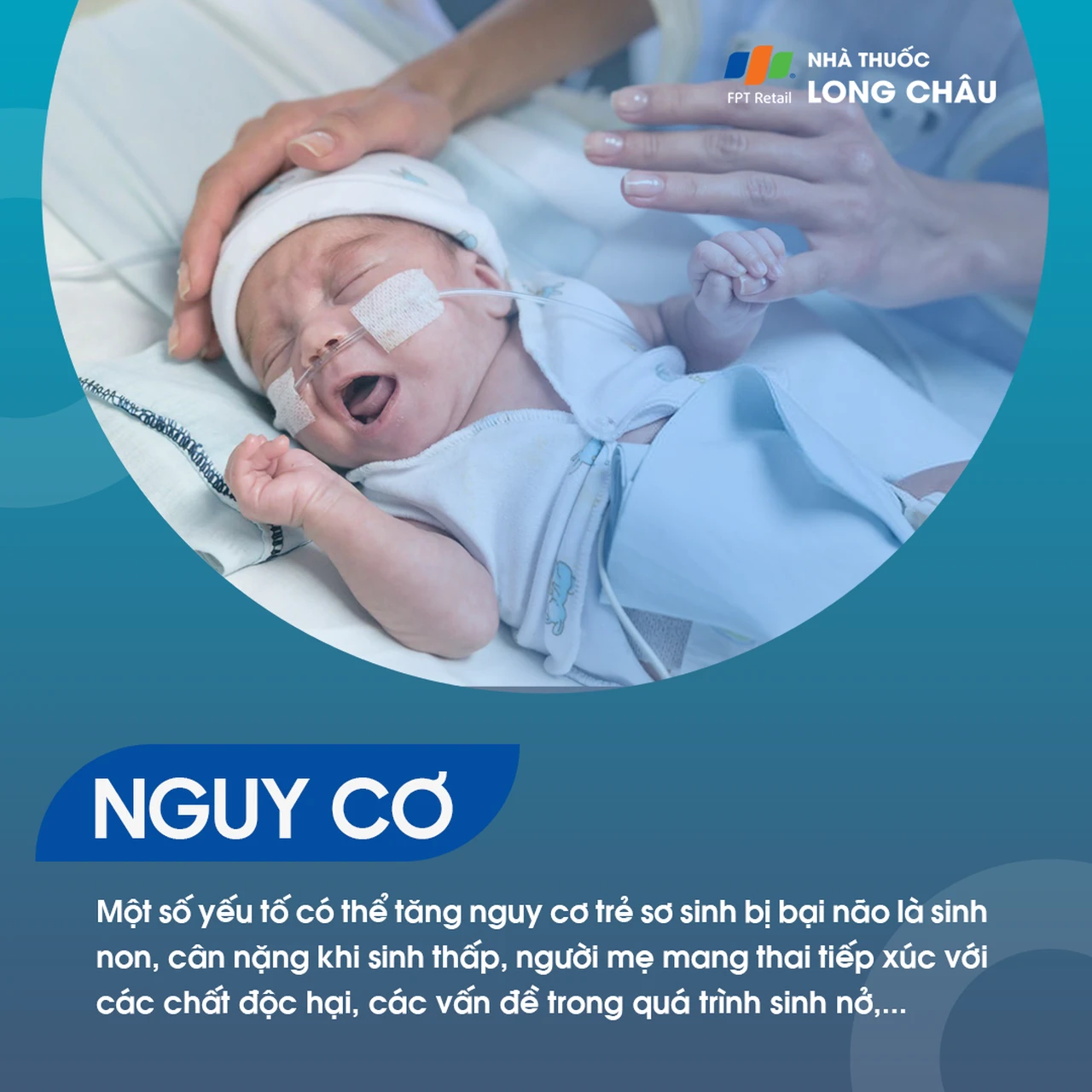 Bại não trẻ em 4