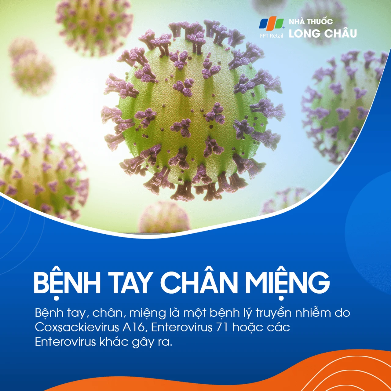 Bệnh tay chân miệng (TCM) là bệnh truyền nhiễm do virus gây ra, phổ biến ở trẻ nhỏ (dưới 5 tuổi)